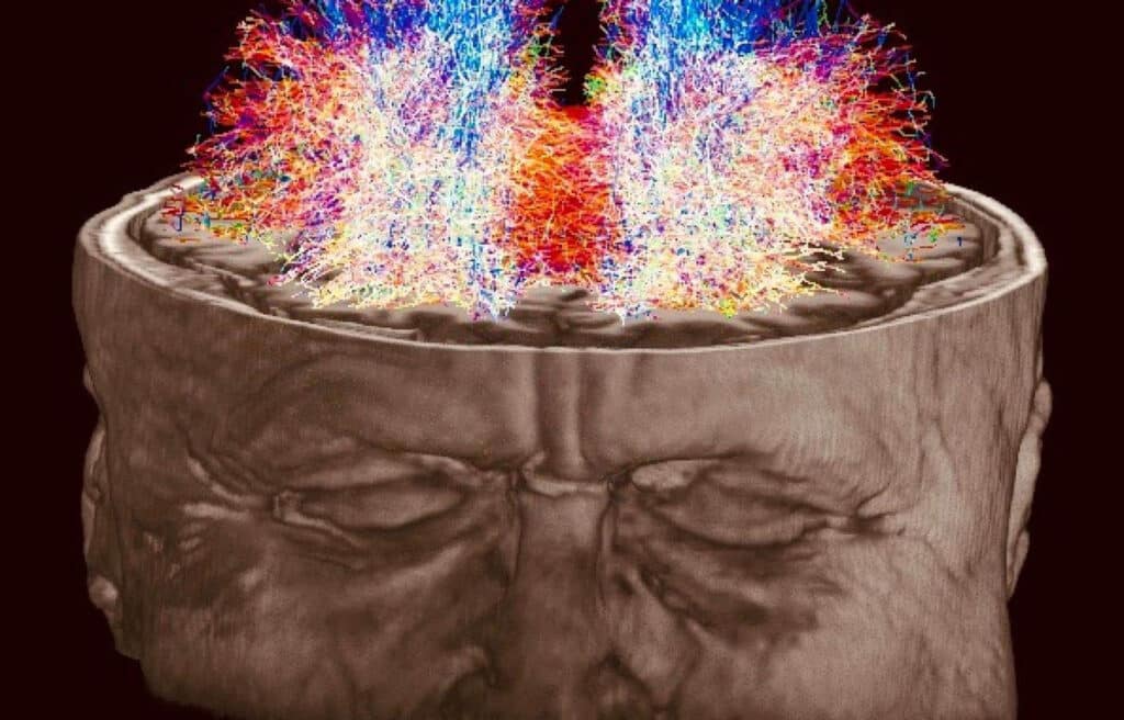 Schéma d'un cerveau illustrant les nombreux bienfaits de la méditation sur la structure et les fonctions cérébrales.