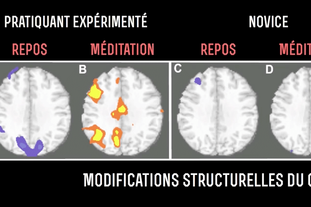 Image illustrative d'un cerveau en pleine évolution grâce à la pratique de la méditation, démontrant les bénéfices scientifiquement prouvés sur le fonctionnement cérébral.